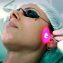 Laserterapia